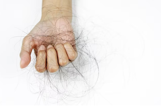 The Best Treatment For Hair Loss